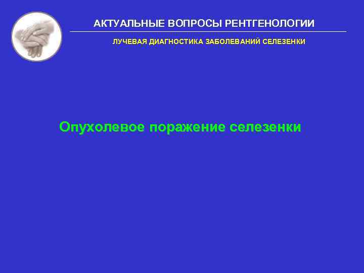 АКТУАЛЬНЫЕ ВОПРОСЫ РЕНТГЕНОЛОГИИ ЛУЧЕВАЯ ДИАГНОСТИКА ЗАБОЛЕВАНИЙ СЕЛЕЗЕНКИ Опухолевое поражение селезенки 