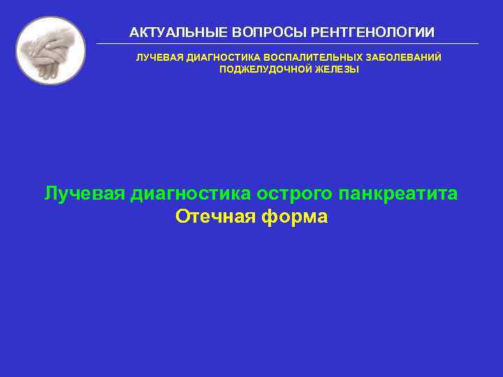 АКТУАЛЬНЫЕ ВОПРОСЫ РЕНТГЕНОЛОГИИ ЛУЧЕВАЯ ДИАГНОСТИКА ВОСПАЛИТЕЛЬНЫХ ЗАБОЛЕВАНИЙ ПОДЖЕЛУДОЧНОЙ ЖЕЛЕЗЫ Лучевая диагностика острого панкреатита Отечная