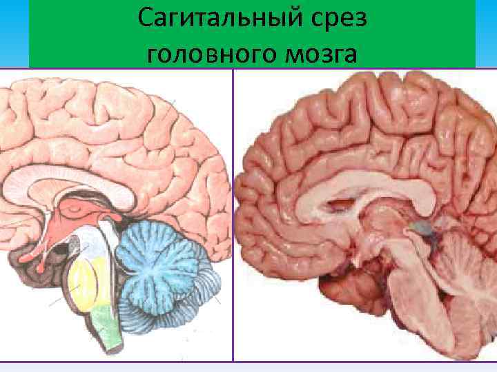 Сагитальный срез головного мозга 