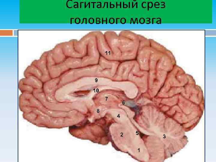 Сагитальный срез головного мозга 11 9 10 7 8 6 4 2 5 1