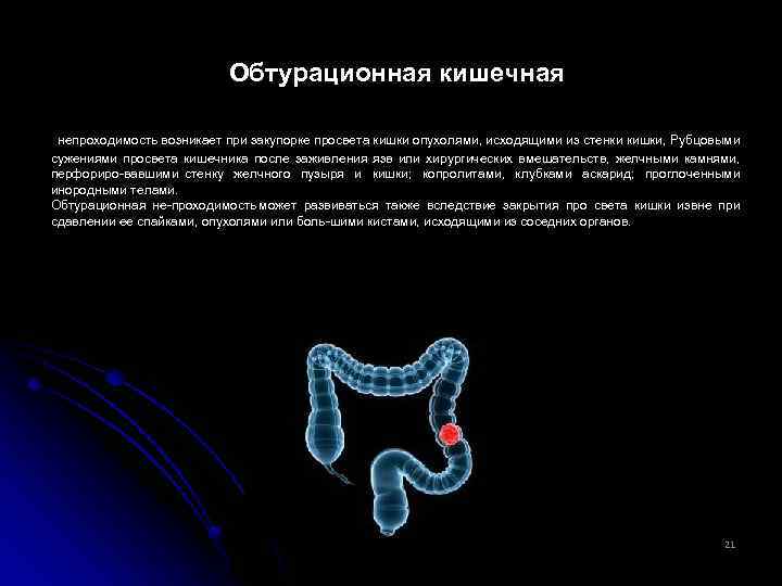 Обтурационная форма рака. Обтурационная кишечная непроходимость. Обтурационный кишечной непроходимости. Проходимость кишечника.