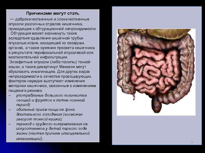 Причинами могут стать — доброкачественные и злокачественные опухоли различных отделов кишечника, приводящие к обтурационной