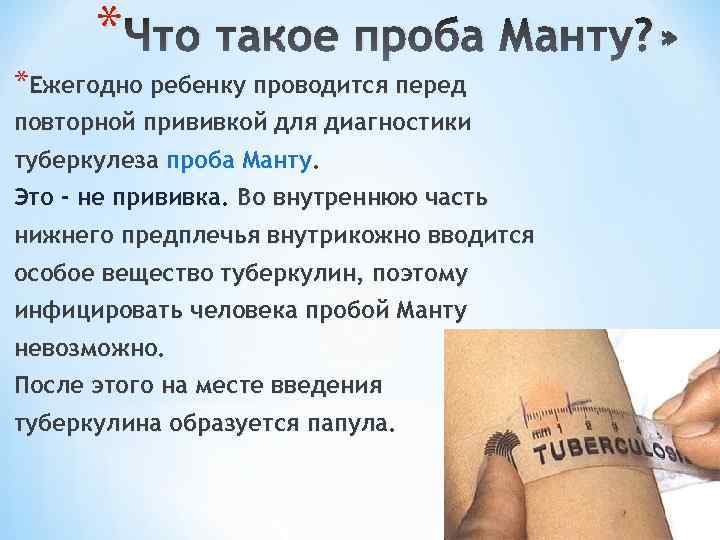 * Что такое проба Манту? » *Ежегодно ребенку проводится перед повторной прививкой для диагностики