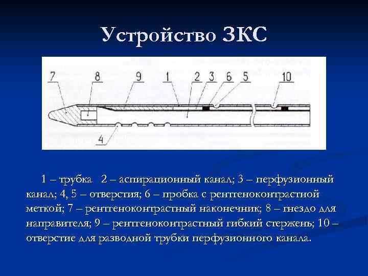Устройство ЗКС 1 – трубка 2 – аспирационный канал; 3 – перфузионный канал; 4,