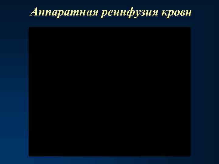 Аппаратная реинфузия крови 