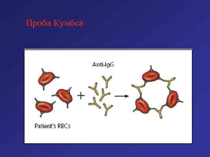 Проба Кумбса 