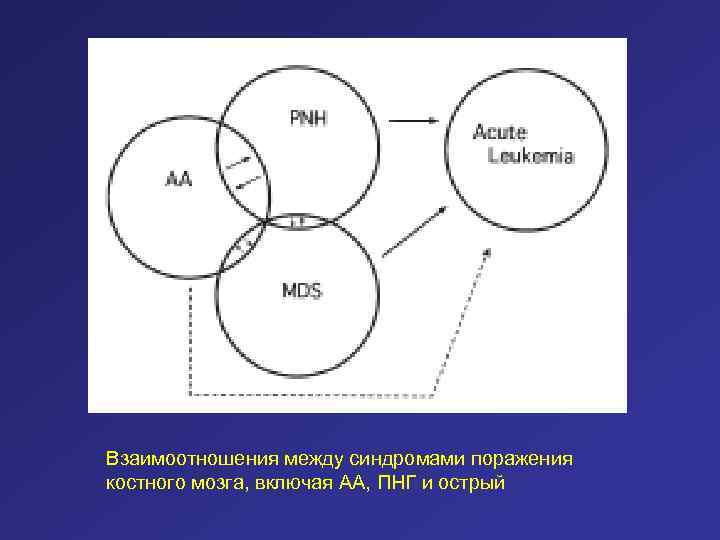 Взаимоотношения между синдромами поражения костного мозга, включая АА, ПНГ и острый 