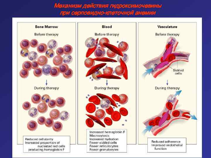Механизм действия гидроксимочевины при серповидно-клеточной анемии 