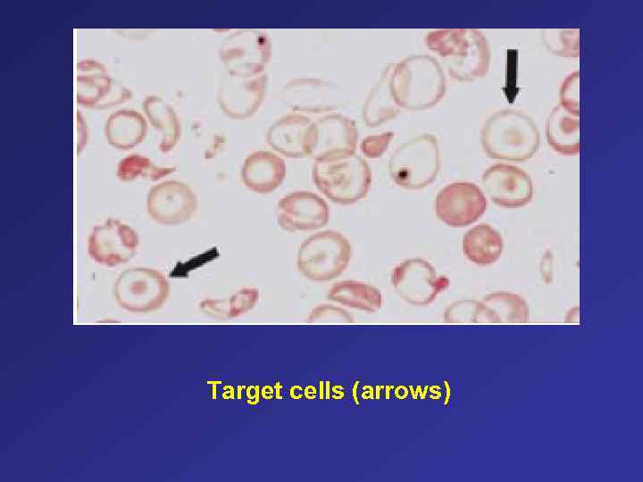 Target cells (arrows) 