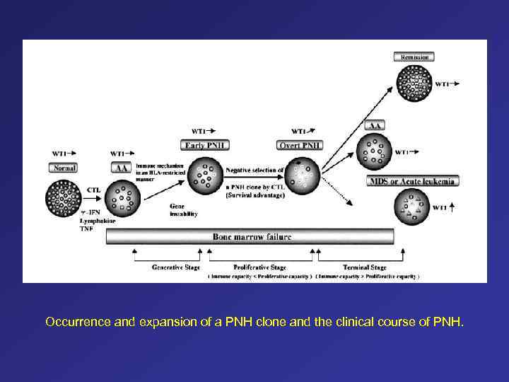 Occurrence and expansion of a PNH clone and the clinical course of PNH. 