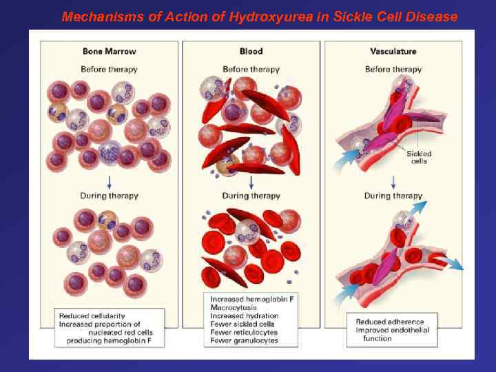 Mechanisms of Action of Hydroxyurea in Sickle Cell Disease 