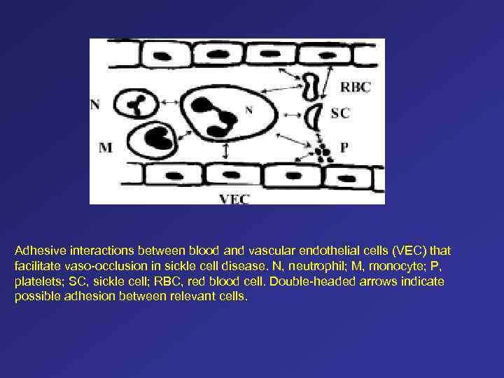 Adhesive interactions between blood and vascular endothelial cells (VEC) that facilitate vaso-occlusion in sickle