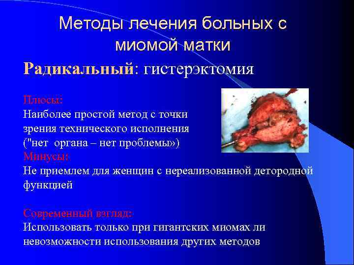 Методы лечения больных с миомой матки Радикальный: гистерэктомия Плюсы: Наиболее простой метод с точки