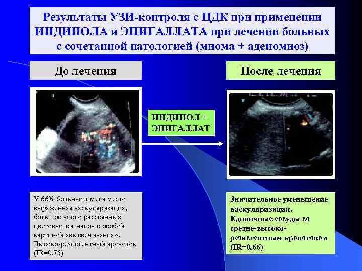 Цдк исследование. Цветовое допплеровское картирование. УЗИ С цветовым допплеровским картированием. Локус кровотока на УЗИ что такое.