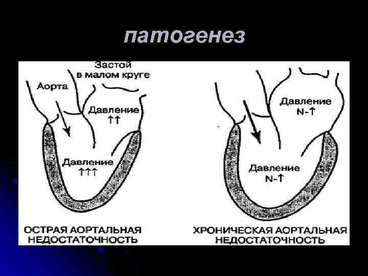 патогенез 