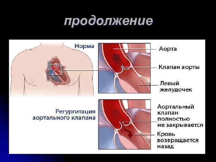 продолжение 