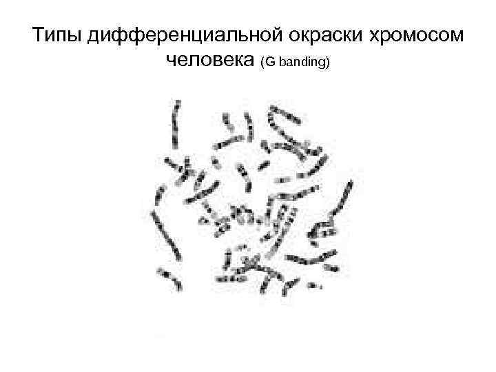 Типы дифференциальной окраски хромосом человека (G banding) 