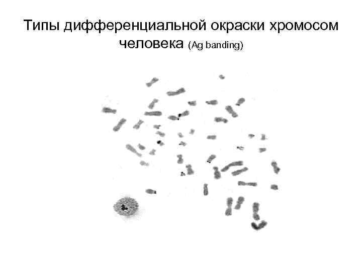 Типы дифференциальной окраски хромосом человека (Ag banding) 