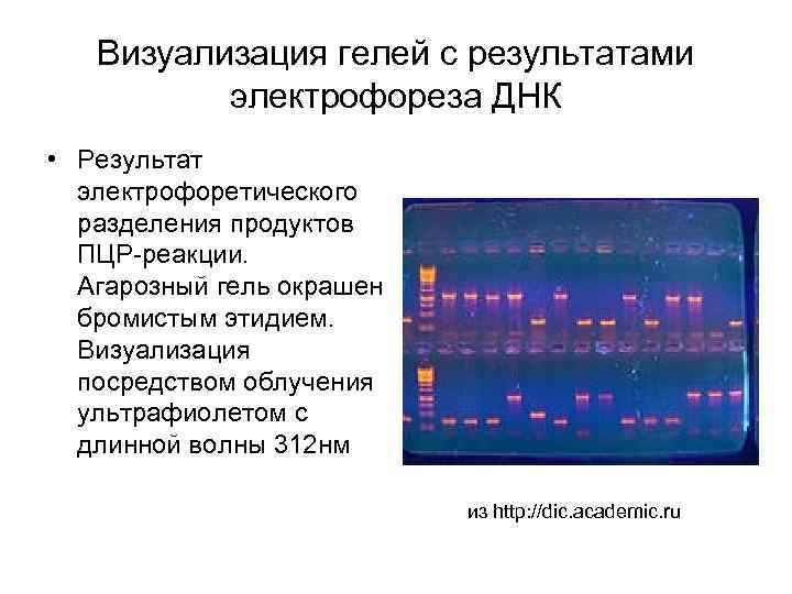 Визуализация гелей с результатами электрофореза ДНК • Результат электрофоретического разделения продуктов ПЦР-реакции. Агарозный гель