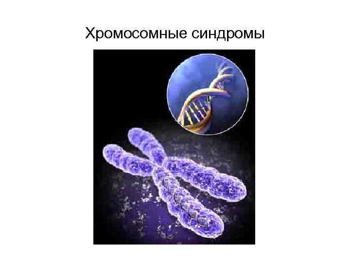 Хромосомные синдромы 