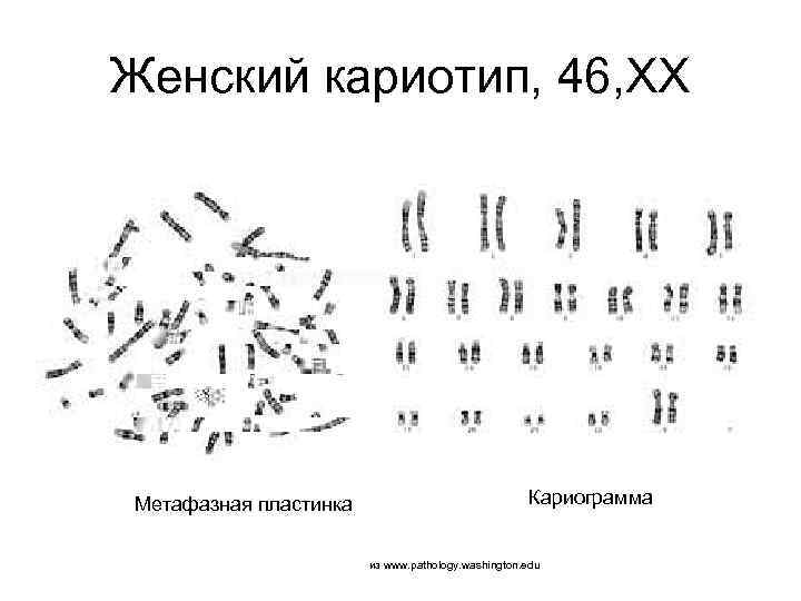 Женский кариотип, 46, ХХ Метафазная пластинка Кариограмма из www. pathology. washington. edu 