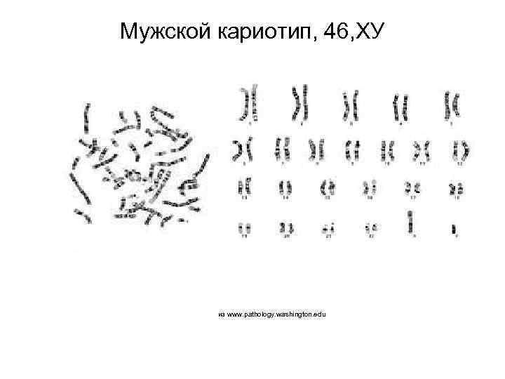 Мужской кариотип, 46, ХУ из www. pathology. washington. edu 