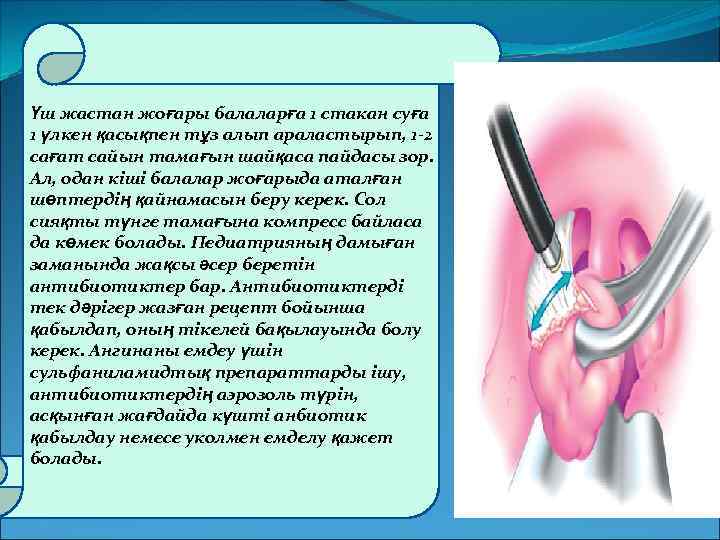 Үш жастан жоғары балаларға 1 стакан суға 1 үлкен қасықпен тұз алып араластырып, 1