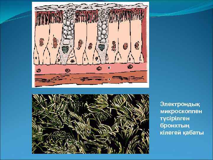 Электрондық микроскоппен түсірілген бронхтың кілегей қабаты 