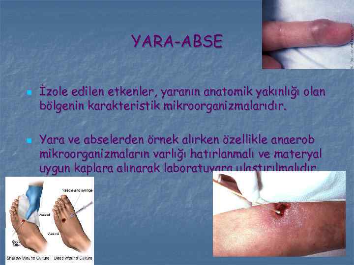 YARA-ABSE n n İzole edilen etkenler, yaranın anatomik yakınlığı olan bölgenin karakteristik mikroorganizmalarıdır. Yara
