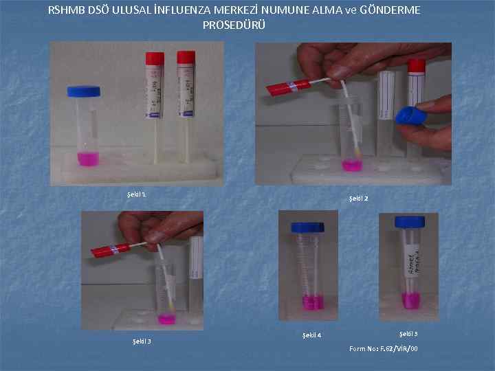 RSHMB DSÖ ULUSAL İNFLUENZA MERKEZİ NUMUNE ALMA ve GÖNDERME PROSEDÜRÜ Şekil 1 Şekil 3