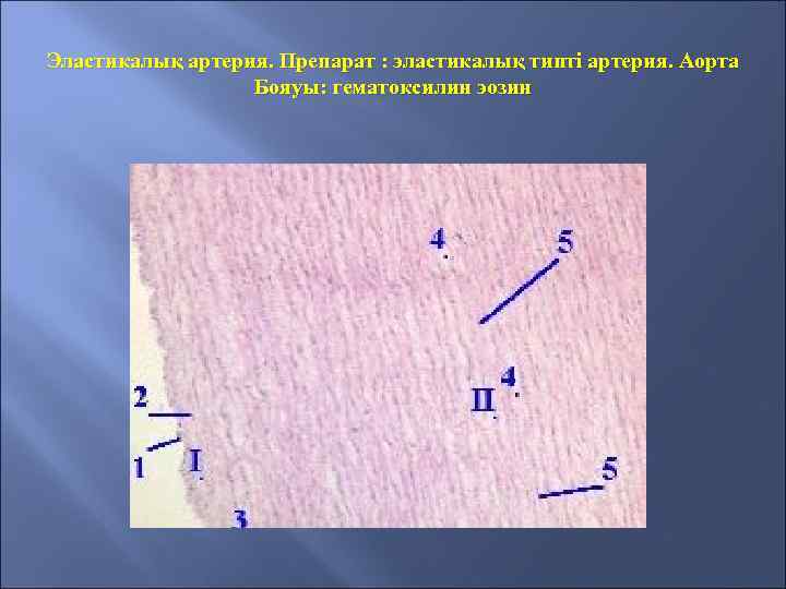 Эластикалық артерия. Препарат : эластикалық типті артерия. Аорта Бояуы: гематоксилин эозин 