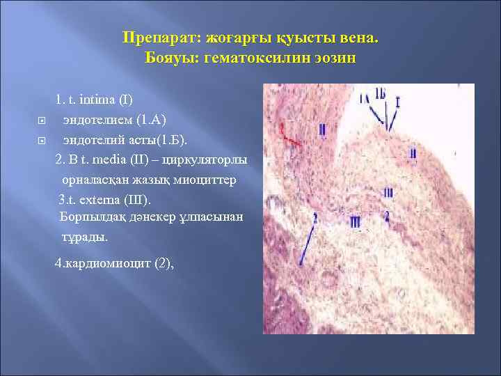 Препарат: жоғарғы қуысты вена. Бояуы: гематоксилин эозин 1. t. intima (I) эндотелием (1. А)