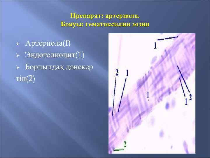 Препарат: артериола. Бояуы: гематоксилин эозин Артериола(I) Ø Эндотелиоцит(1) Ø Борпылдақ дәнекер тін(2) Ø 
