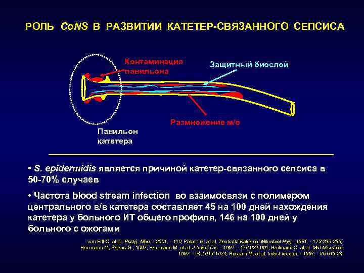 Профилактика инфекций кровотока. Павильон катетера. Катетер-ассоциированные сепсис. Катетер-ассоциированные инфекции значение s epidermidis. Инфицирование порта с развитием катетерного сепсиса симптомы.