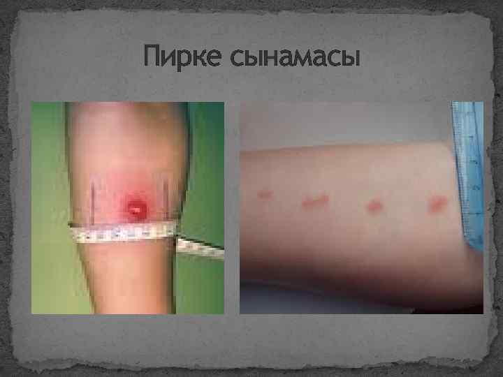 Пирке сынамасы 