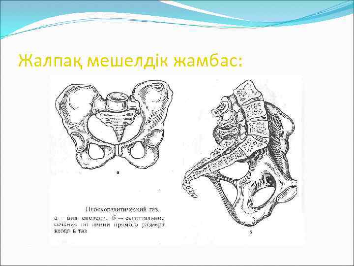 Жалпақ мешелдік жамбас: 
