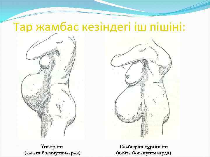 Тар жамбас кезіндегі іш пішіні: Үшкір іш (алғаш босанушыларда) Салбырап тұрған іш (қайта босанушыларда)