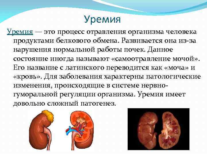 Уремия — это процесс отравления организма человека продуктами белкового обмена. Развивается она из-за нарушения