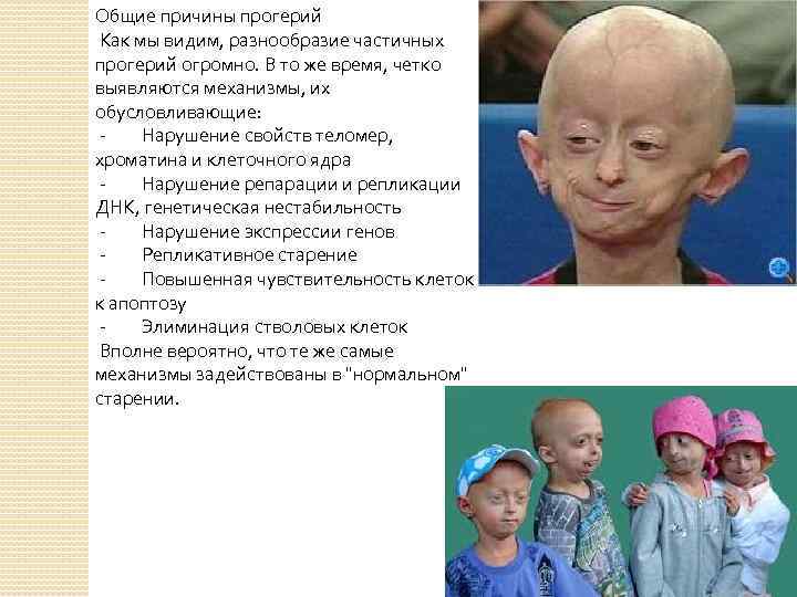 Общие причины прогерий Как мы видим, разнообразие частичных прогерий огромно. В то же время,