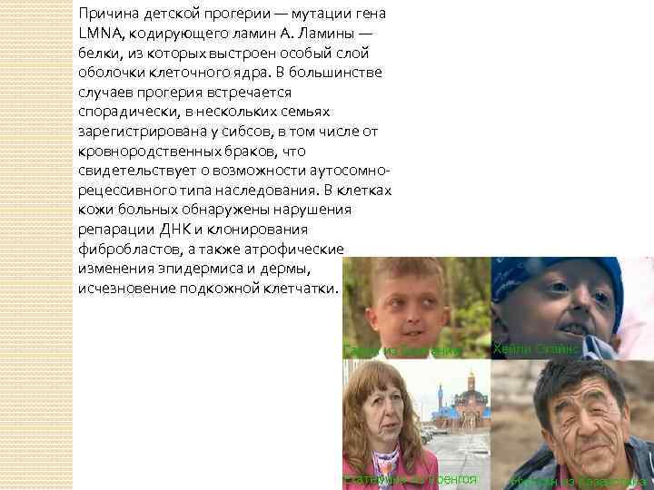 Причина детской прогерии — мутации гена LMNA, кодирующего ламин А. Ламины — белки, из