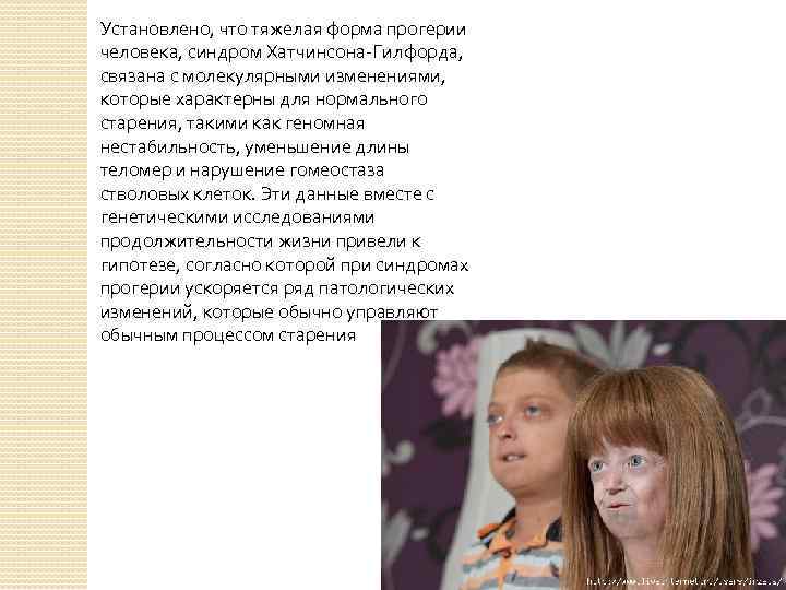 Установлено, что тяжелая форма прогерии человека, синдром Хатчинсона-Гилфорда, связана с молекулярными изменениями, которые характерны