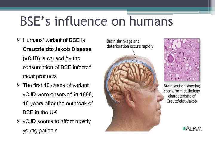 BSE’s influence on humans Ø Humans’ variant of BSE is Creutzfeldtt-Jakob Disease (v. CJD)