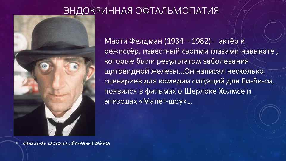 ЭНДОКРИННАЯ ОФТАЛЬМОПАТИЯ Марти Фелдман (1934 – 1982) – актёр и режиссёр, известный своими глазами