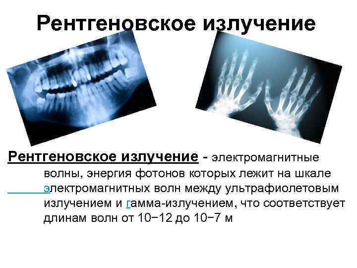 Рентгеновское излучение - электромагнитные волны, энергия фотонов которых лежит на шкале электромагнитных волн между