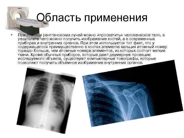 Область применения • При помощи рентгеновских лучей можно «просветить» человеческое тело, в результате чего