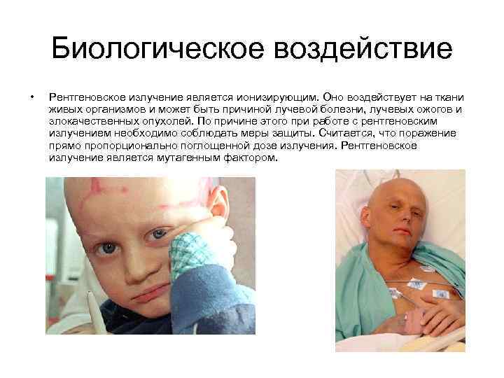 Биологическое воздействие • Рентгеновское излучение является ионизирующим. Оно воздействует на ткани живых организмов и