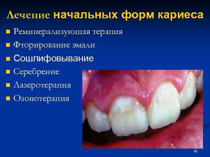 Лечение начальных форм кариеса n n n Реминерализующая терапия Фторирование эмали Сошлифовывание Серебрение Лазеротерапия
