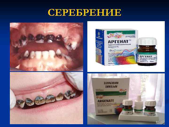 СЕРЕБРЕНИЕ 62 
