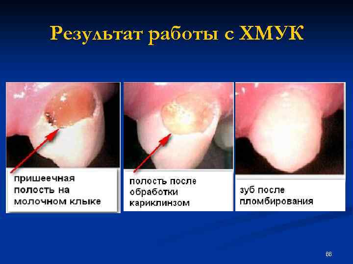 Результат работы с ХМУК 66 