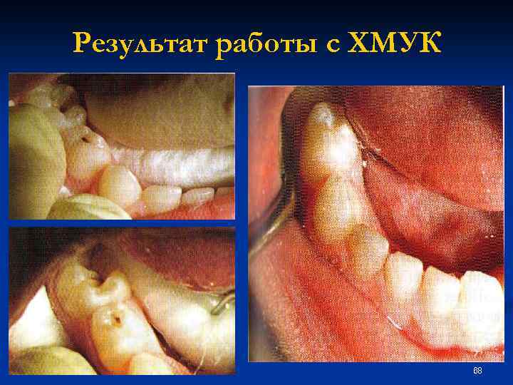 Результат работы с ХМУК 68 